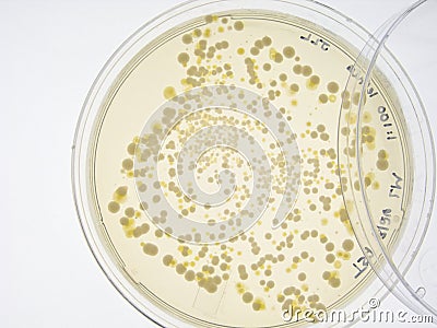   on Bacterial Colonies On Agar Plate  Click Image To Zoom