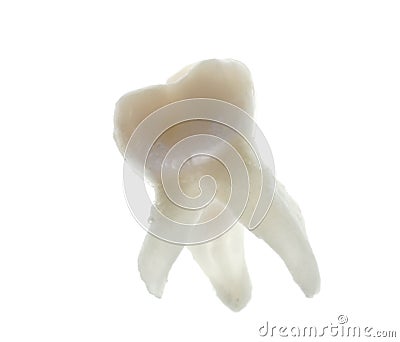 Exposed Tooth Root. ahinkesen, g Molar+teeth+roots