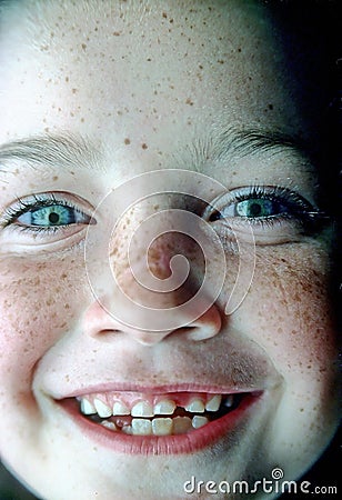 freckle-face-thumb2727047.jpg