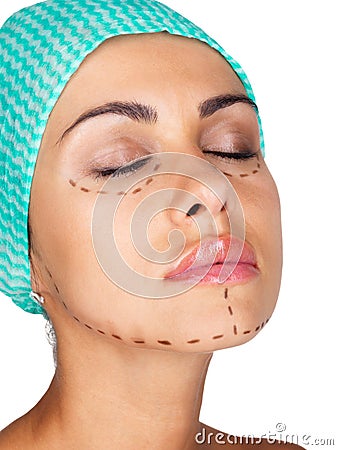 Cosmetic Plastic Surgery on Stock Image  Marking For Cosmetic Plastic Surgery  Image  18820266