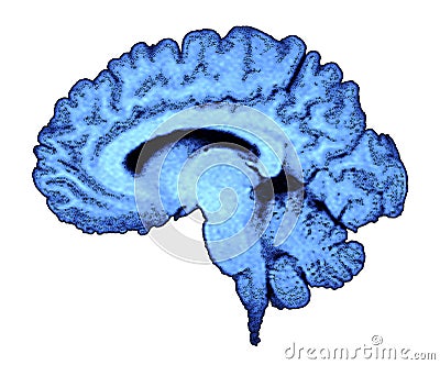 mri brain scan. Scan of a human rain on a white background. Keywords: