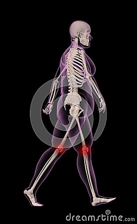 skeletons walking