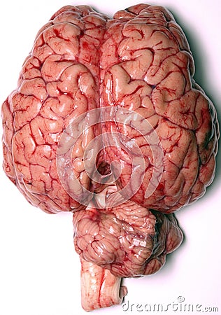 real-brain-thumb146097.jpg